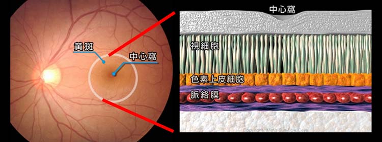 図１、正常な黄斑と中心窩（左：眼底画像、右：断面図）