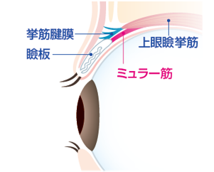 ２、眼瞼下垂とは